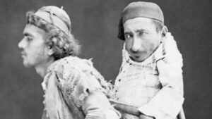 Egy kép a barátságról: a lebénult keresztény és a vak muszlim