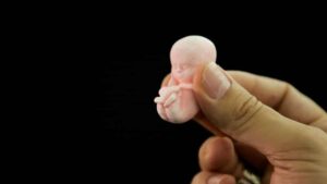 Fogjunk össze egy abortuszmentes Magyarországért!