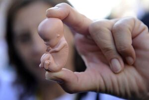 3 ok amiért társadalmunk tükre az abortusz