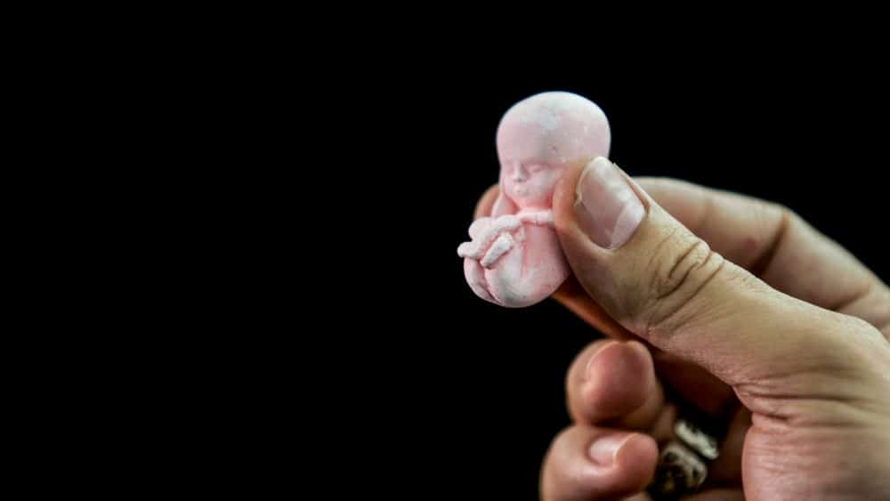 abortusz magzat eletvedelem Custom