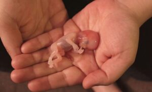 „Nem támogatom a magzatgyilkosságot”: érvek az abortuszra adható katolikus válaszhoz 4 „Nem támogatom a magzatgyilkosságot”: érvek az abortuszra adható katolikus válaszhoz