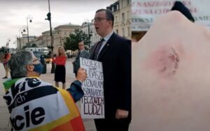 Varsó: Megharapták a Rózsafüzért imádkozó lengyel férfit | VIDEÓ