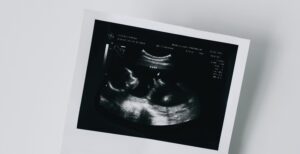 Ez a baj a petesejt-donációval 3 Ez a baj a petesejt-donációval