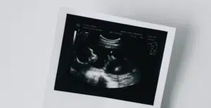 Ez a baj a petesejt-donációval