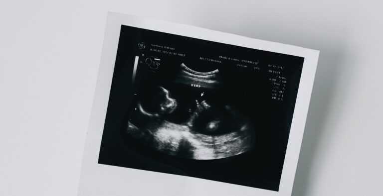 Ez a baj a petesejt-donációval