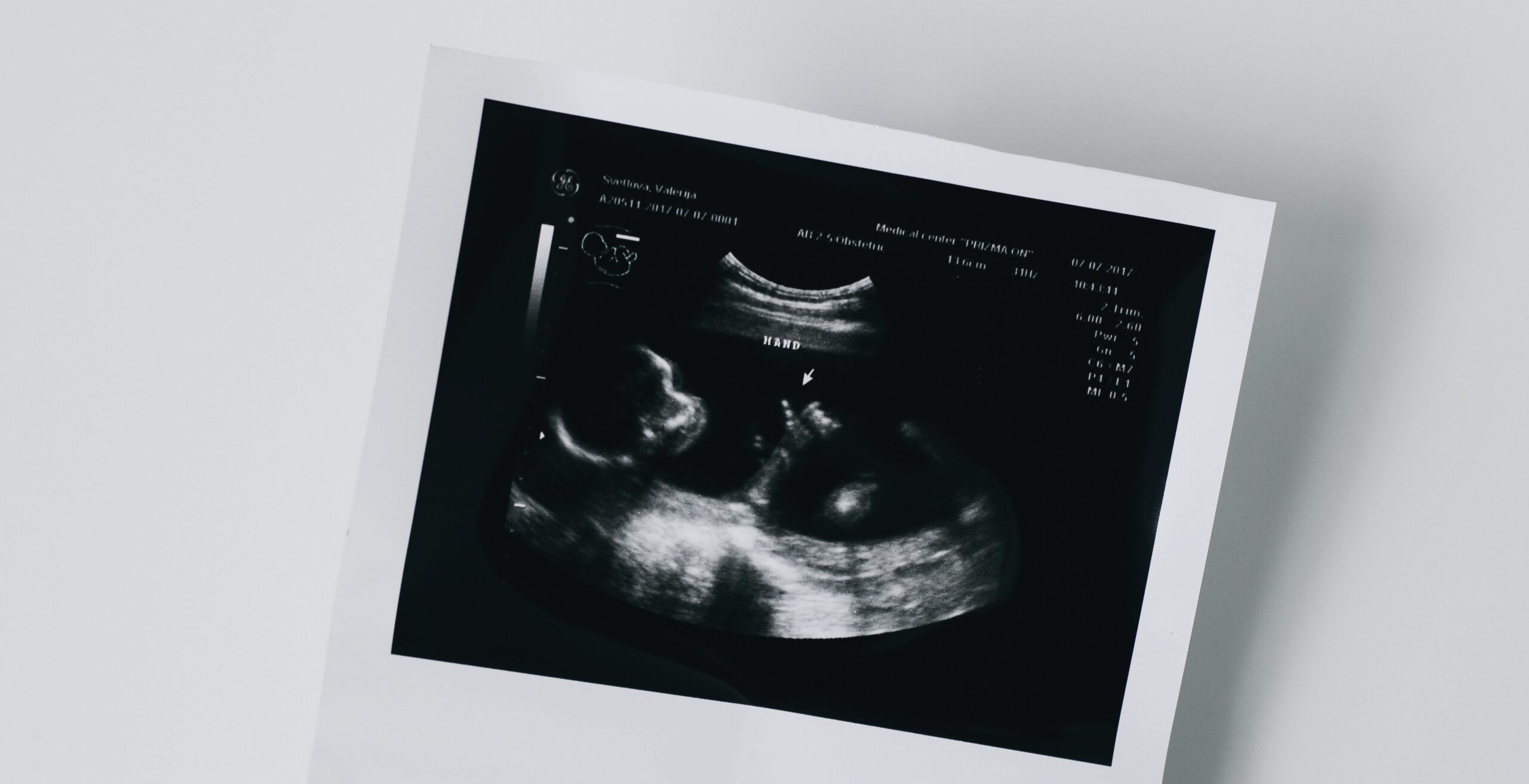 pexels valeriia svietlova 215592657 11837653 scaled